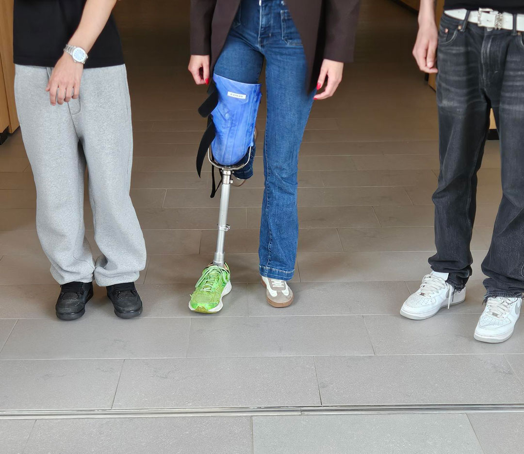Trois enfants dont on ne voit que les jambes. L’enfant du milieu a le genou replié pour essayer une prothèse